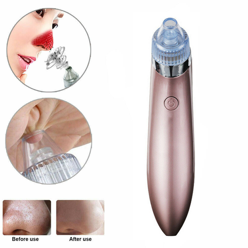 Electric Blackhead Vacuum Pore Cleaner Acne Pimple Remover Strong Suction Tool