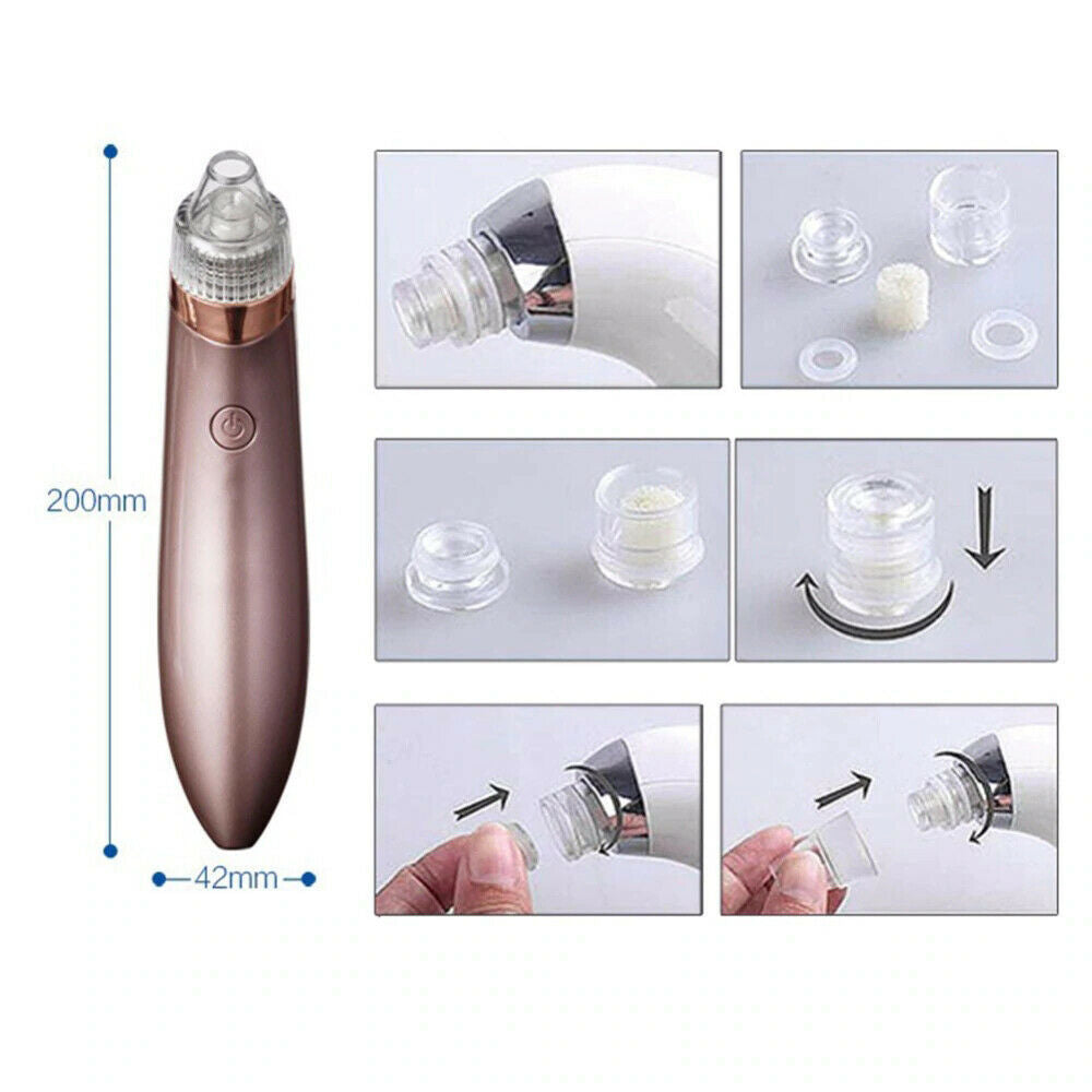 Electric Blackhead Vacuum Pore Cleaner Acne Pimple Remover Strong Suction Tool