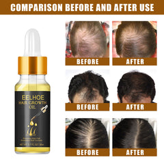 Hair Growth Essential Oil  Care Essential Nutrient Liquid