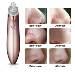 Electric Blackhead Vacuum Pore Cleaner Acne Pimple Remover Strong Suction Tool