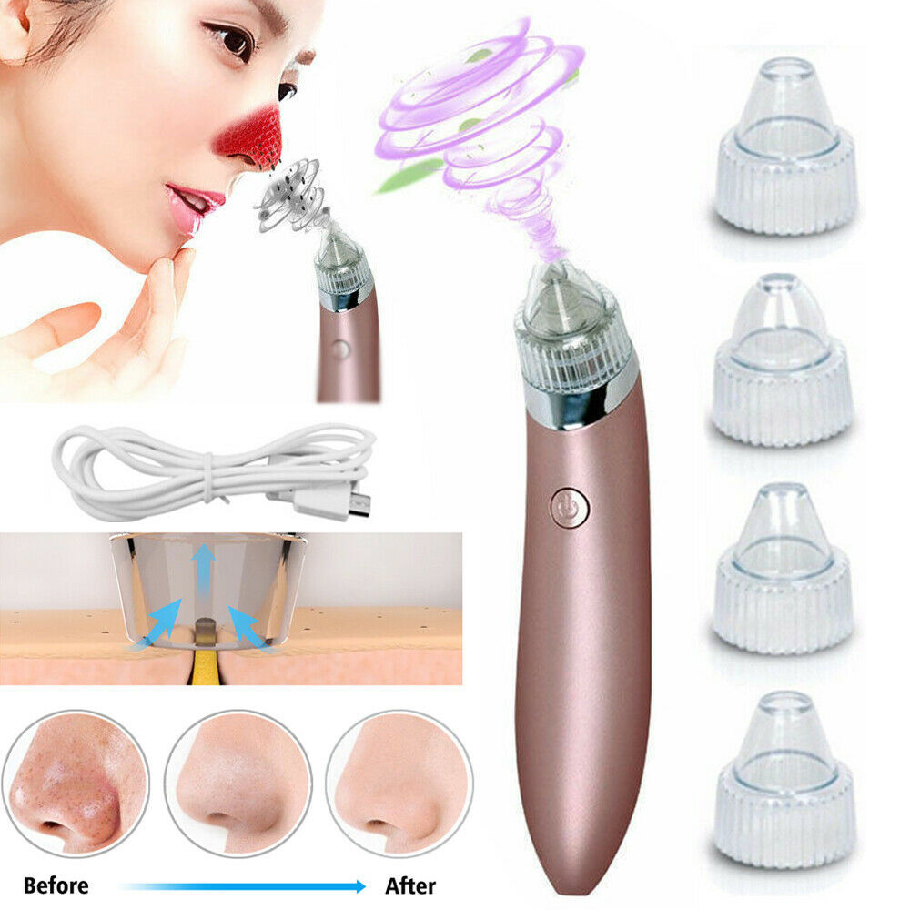 Electric Blackhead Vacuum Pore Cleaner Acne Pimple Remover Strong Suction Tool